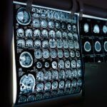Healthcare digital payment adoption outpaces revenue cycle performance, Elavon survey finds Healthcare digital payment adoption outpaces revenue cycle performance, Elavon survey finds